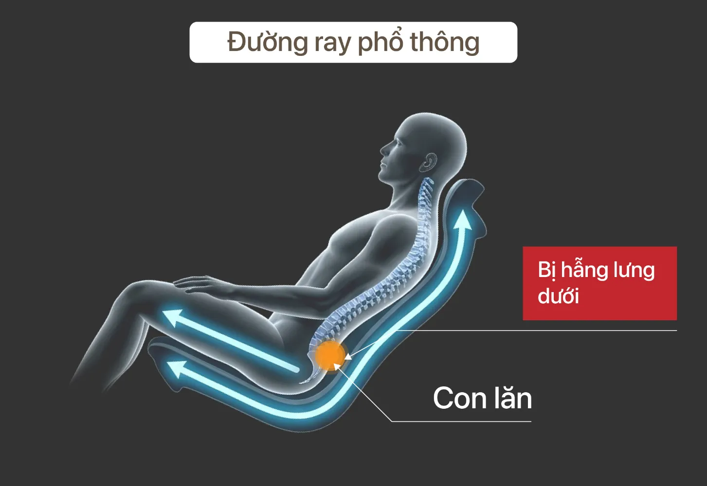 Đường ray ghế massage phổ thông